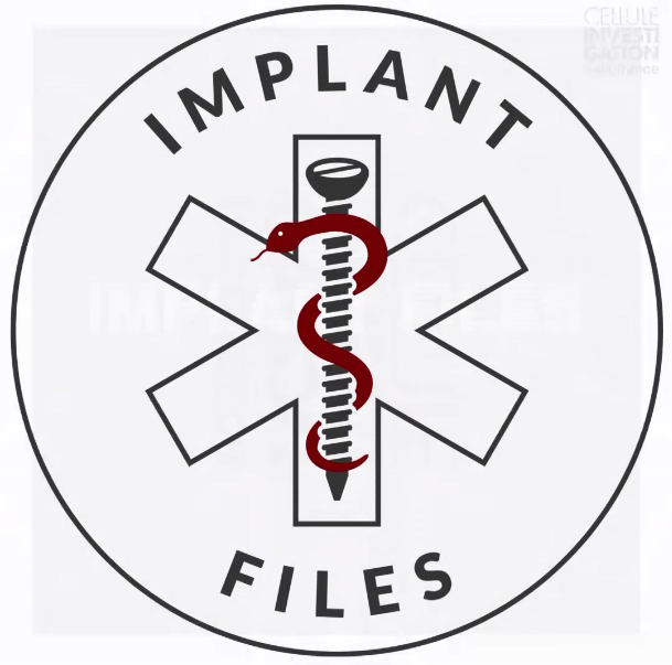 implant files